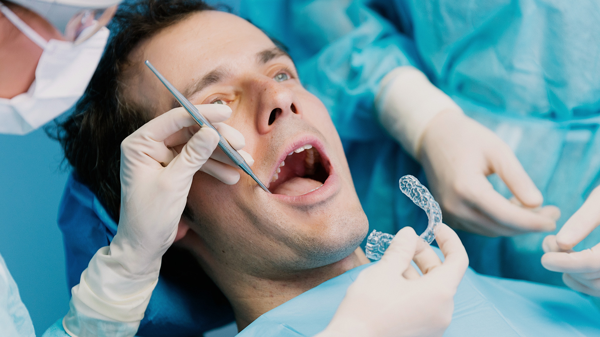best wisdom tooth extraction Singapore