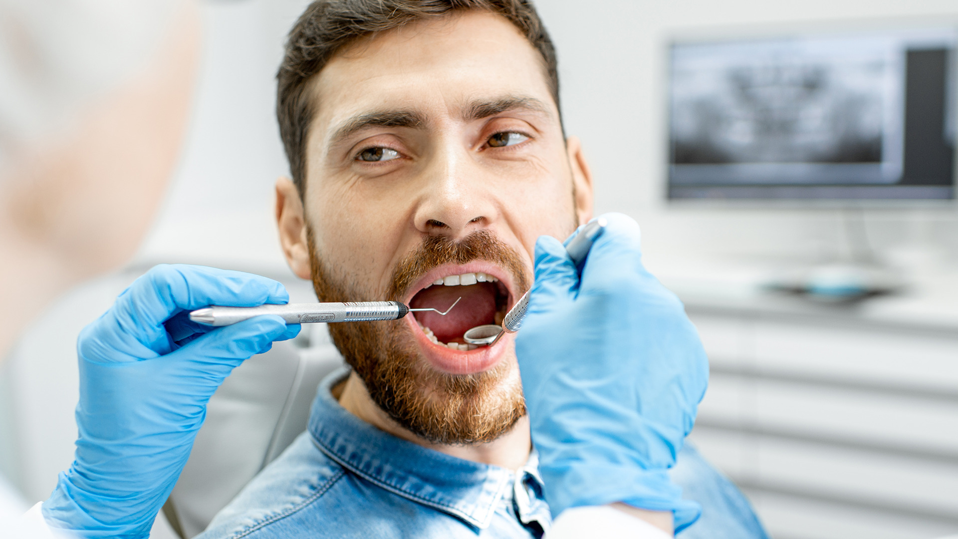 Dental Crowns and Dental Bridges | TEETH @ Tiong Bahru in Singapore