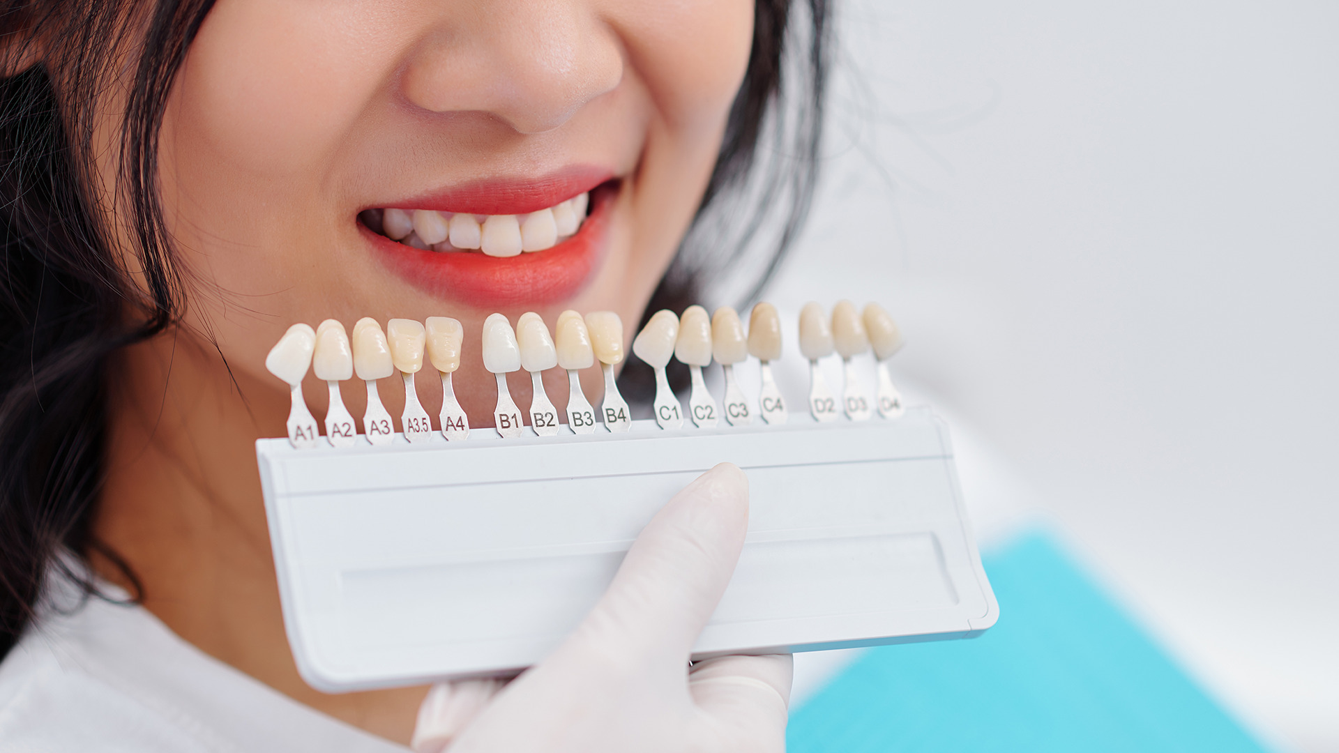 Transform Your Smile Dental Veneers Singapore Porcelain Veneers