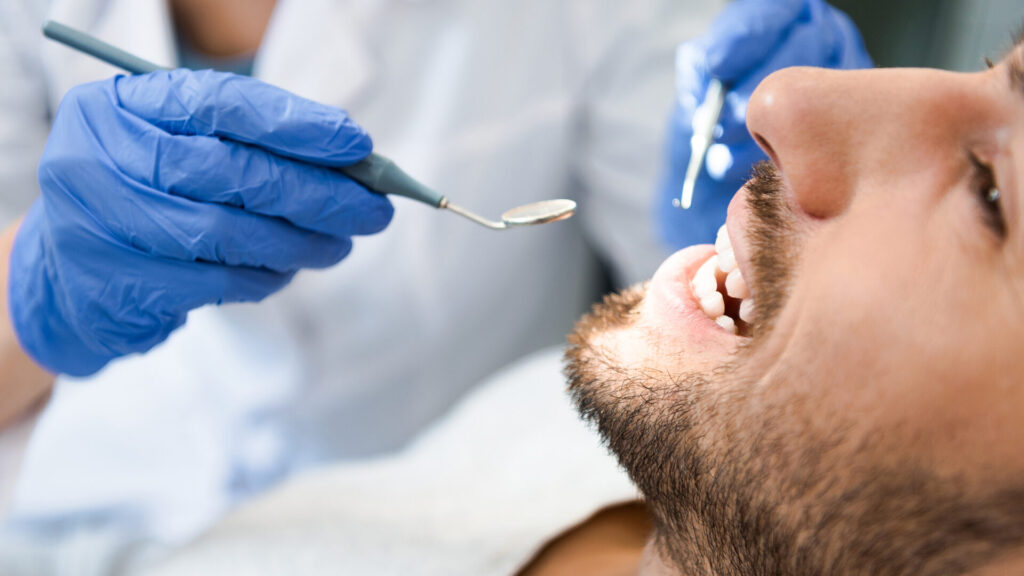 benefits of professional teeth whitening