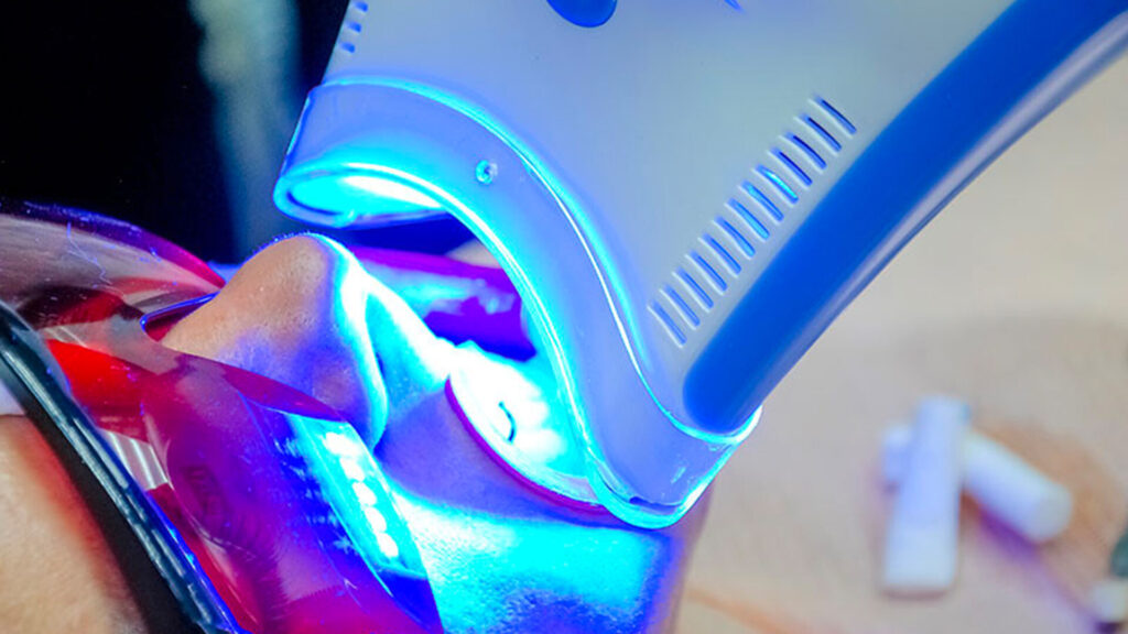 Is UV Light Teeth Whitening Safe?