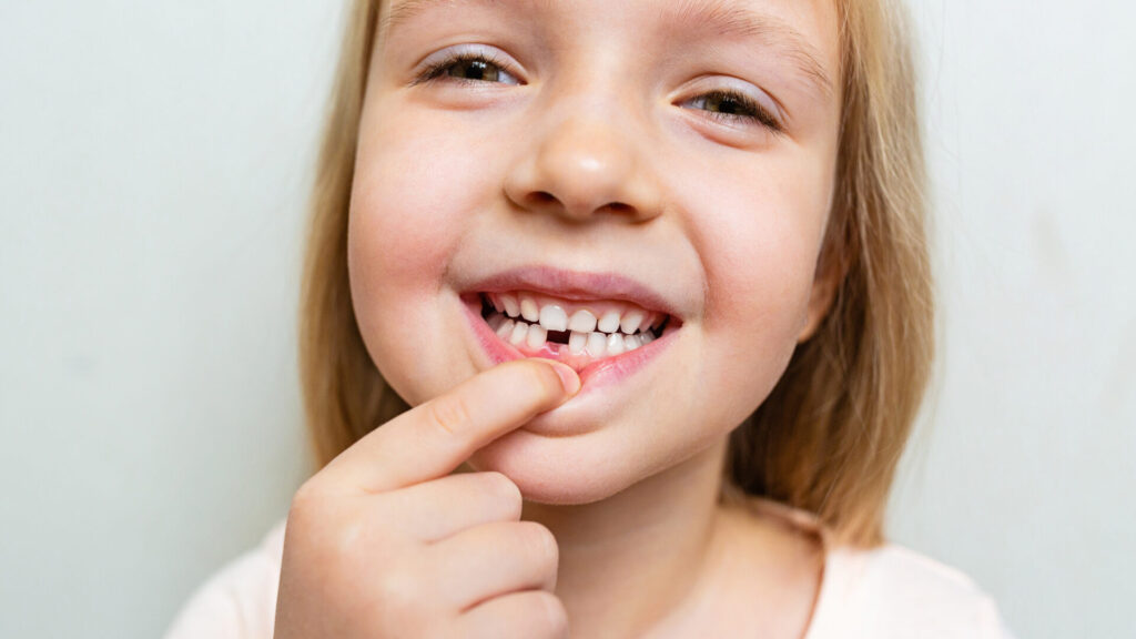 Teeth Grinding in Children | Bruxism Treatment Singapore | TEETH