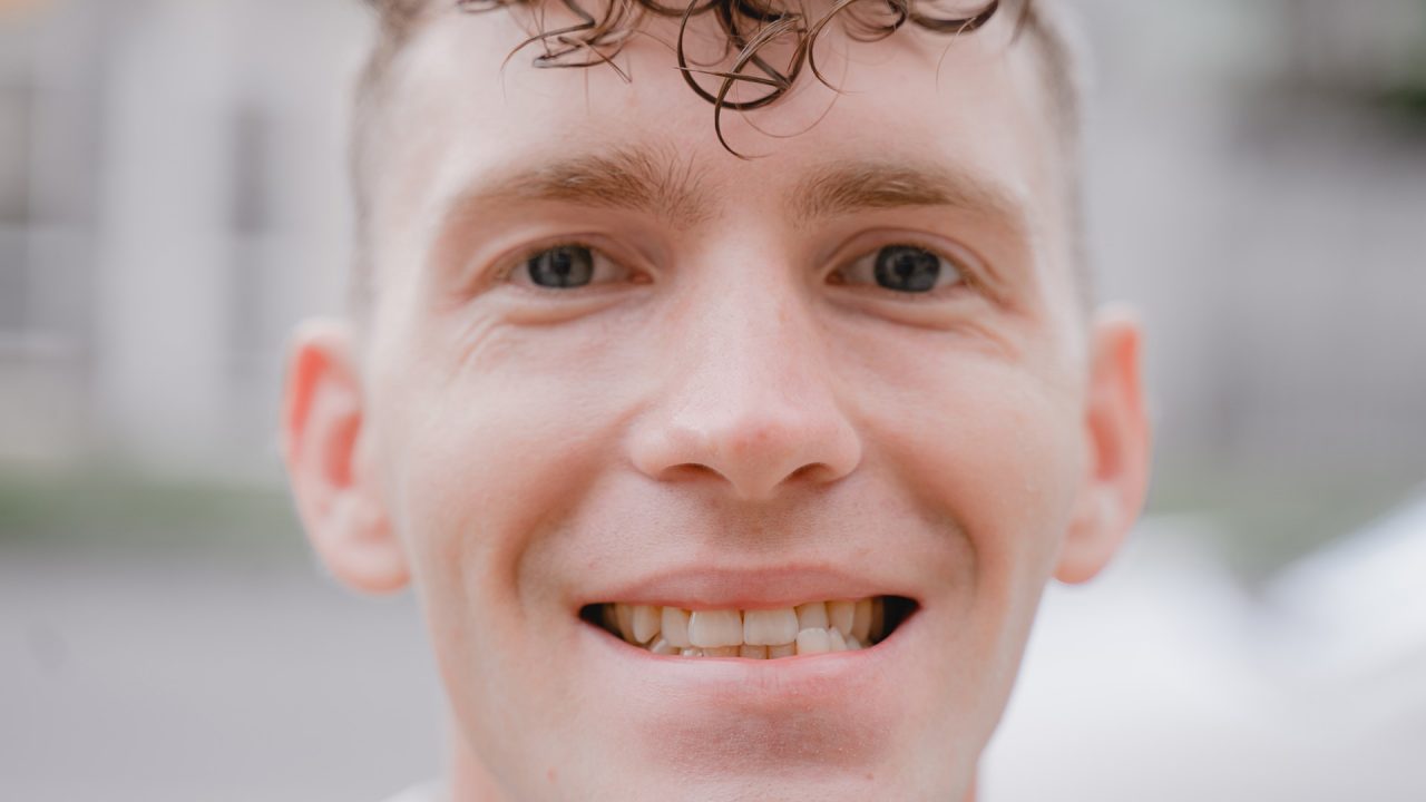 Crooked Teeth Treatment Singapore TEETH TIONG BAHRU