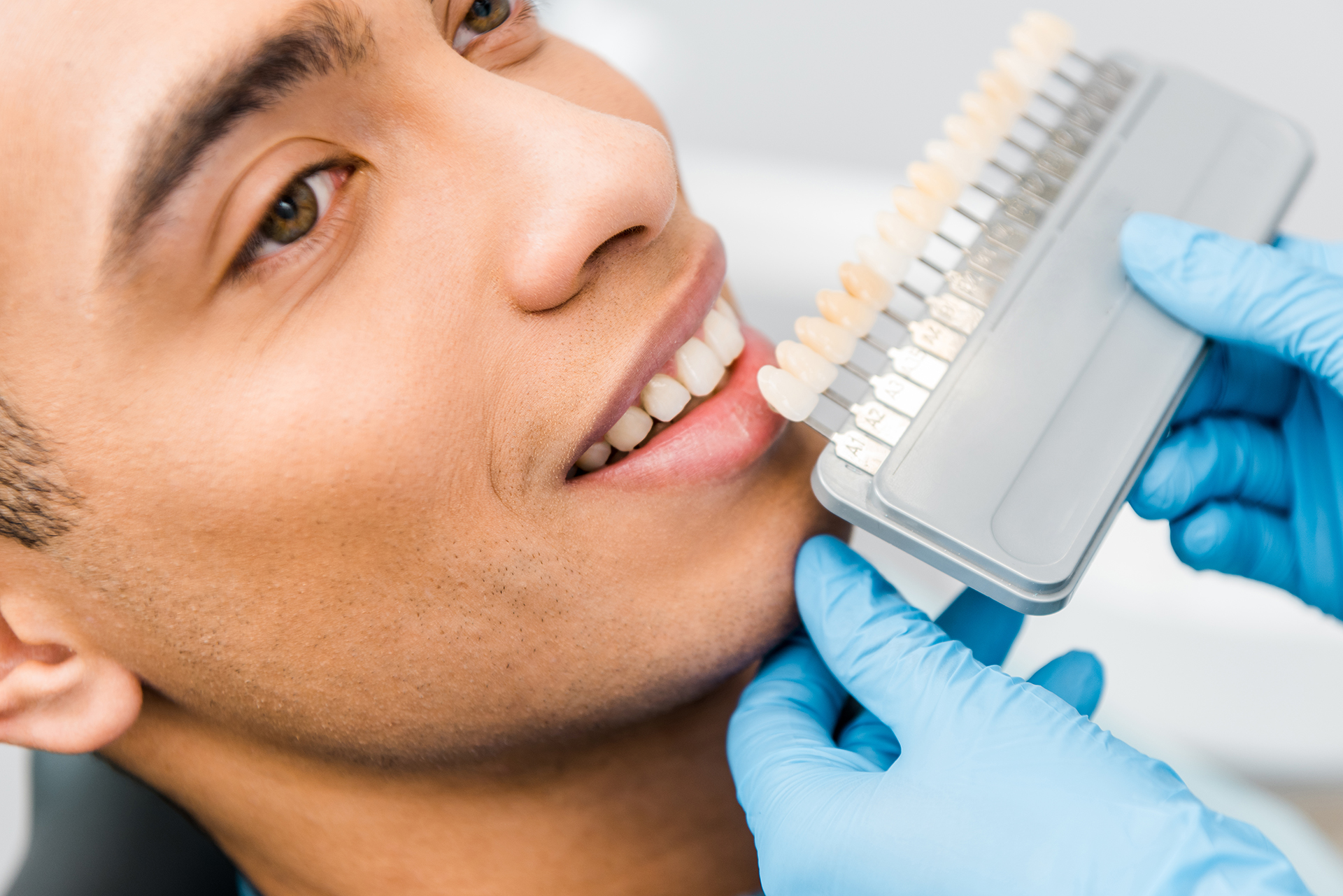 post cosmetic dentistry care