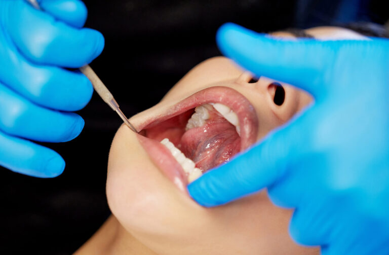 gum infection