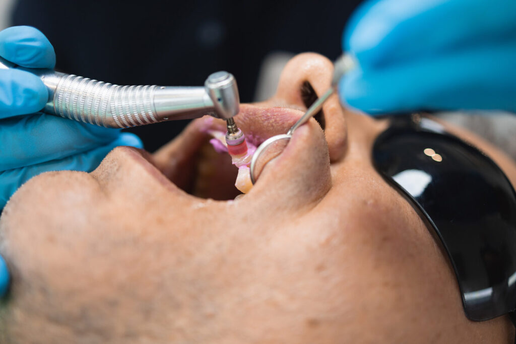 gum recession treatment Singapore