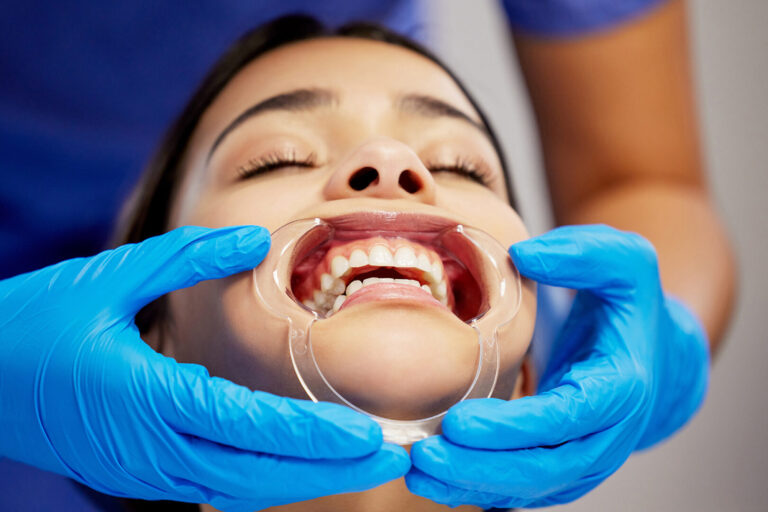 teeth grinding