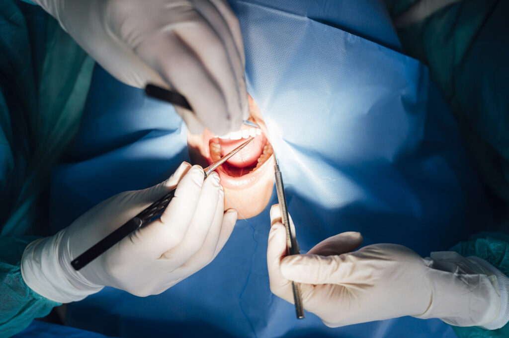 infected wisdom tooth pain relief