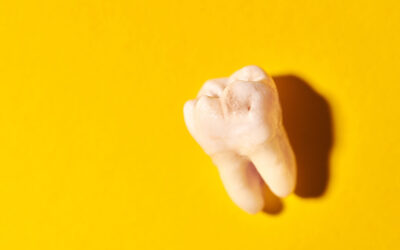 Molar Tooth Extraction: Procedure, Aftercare and Cost in Singapore