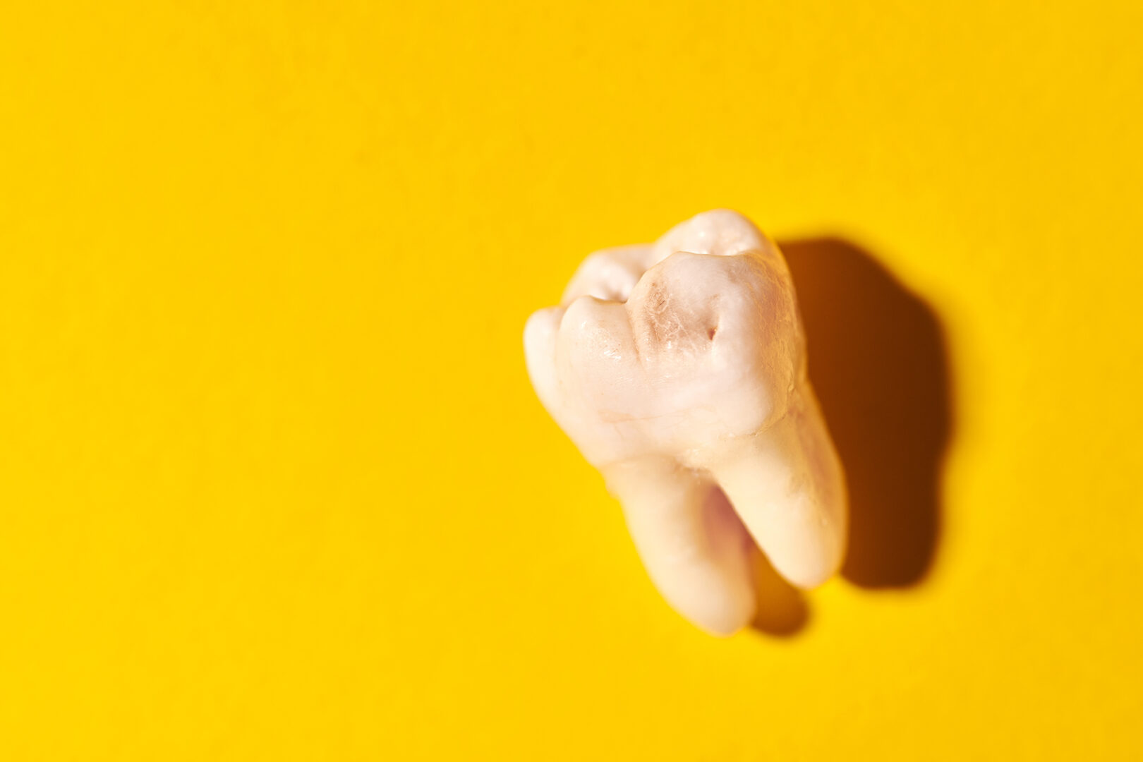 molar tooth extraction