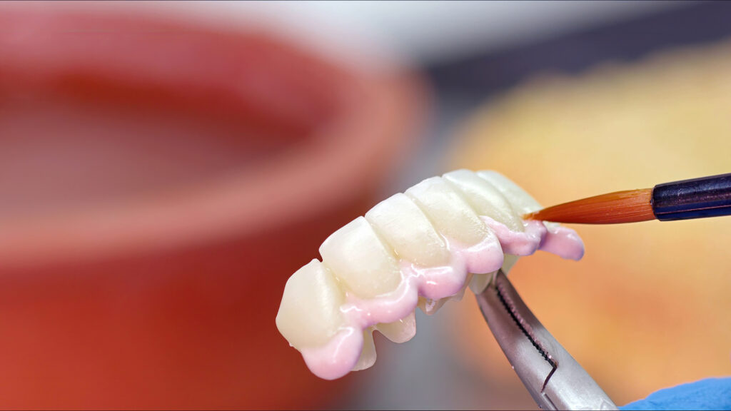 tooth bridge cost Singapore