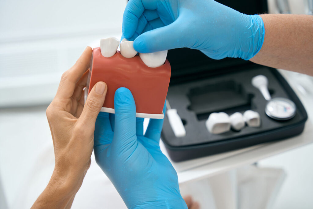 tooth bridge cost in Singapore