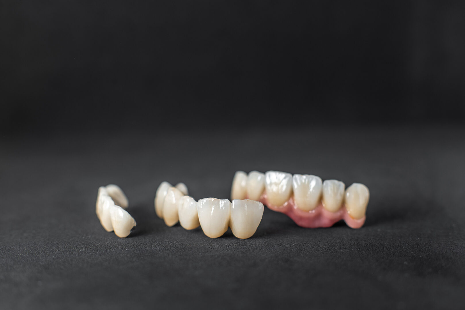 tooth bridge