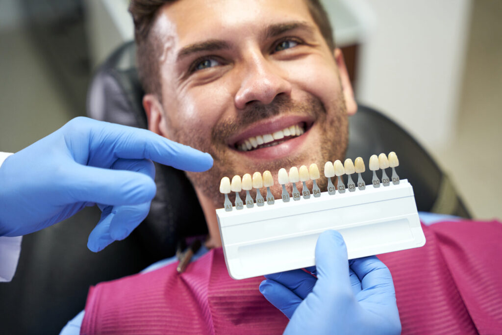 composite veneers cost
