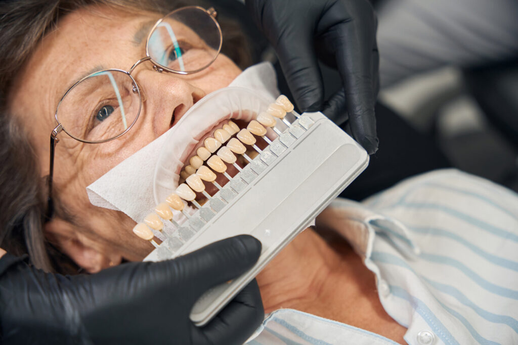 composite veneers cost in Singapore