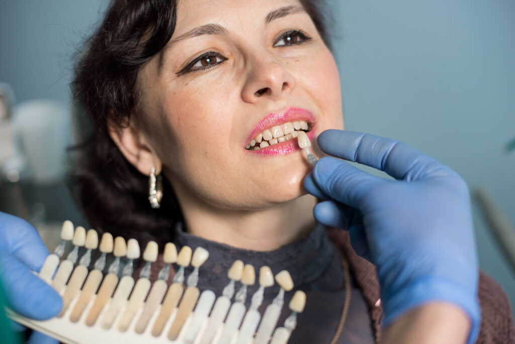 composite veneers procedures