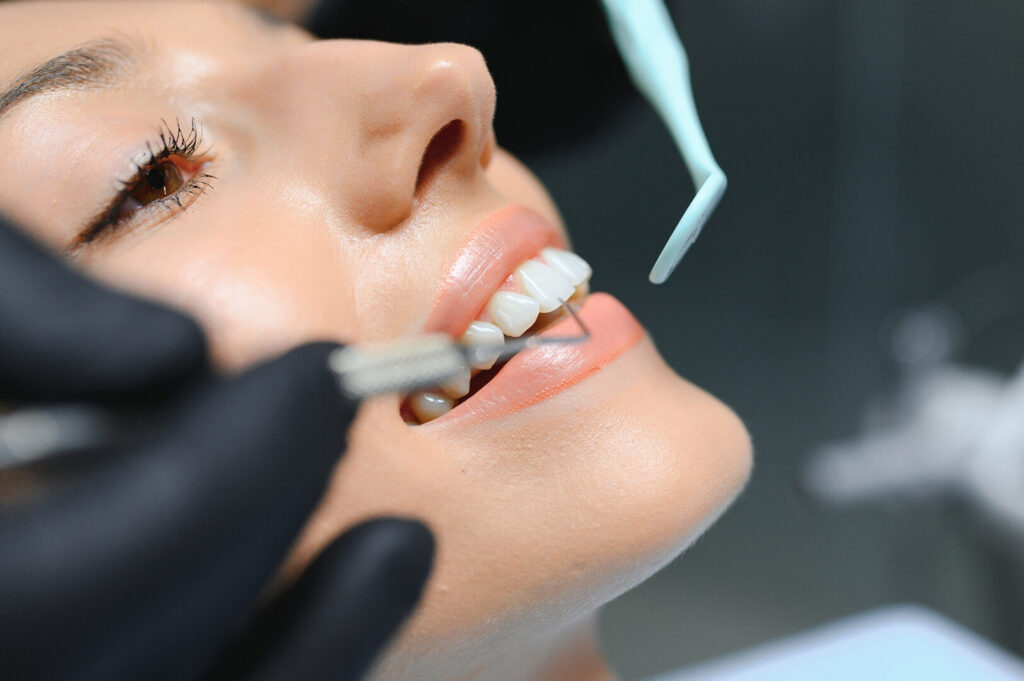 how long do porcelian veneers last