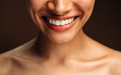 Porcelain Veneers in Singapore: Are They Worth It?