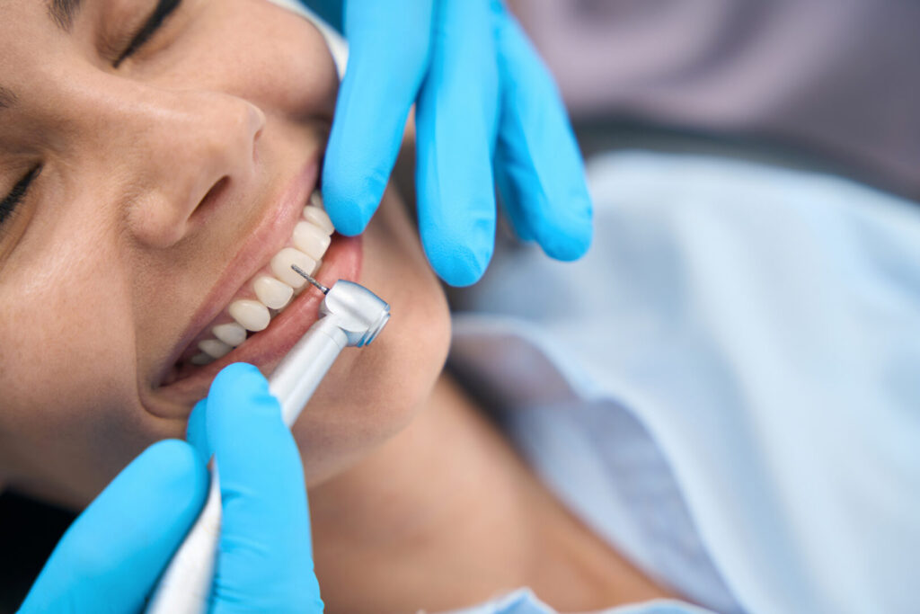 porcelain veneers Singapore