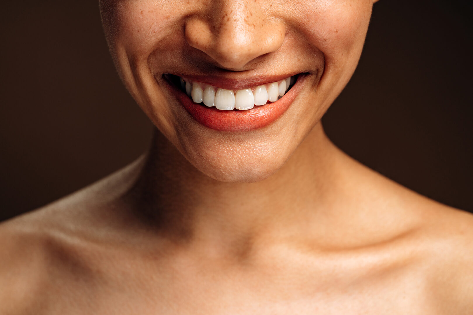 porcelain veneers