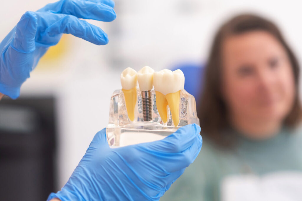 dental implant cost