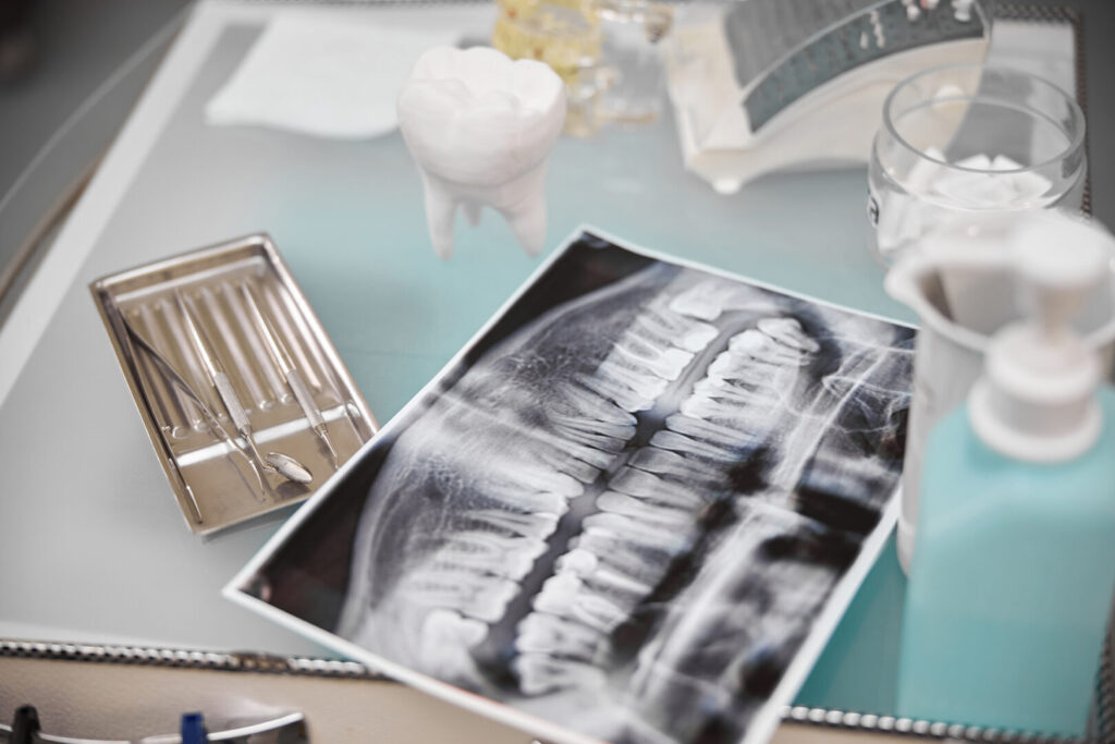 dental implant price