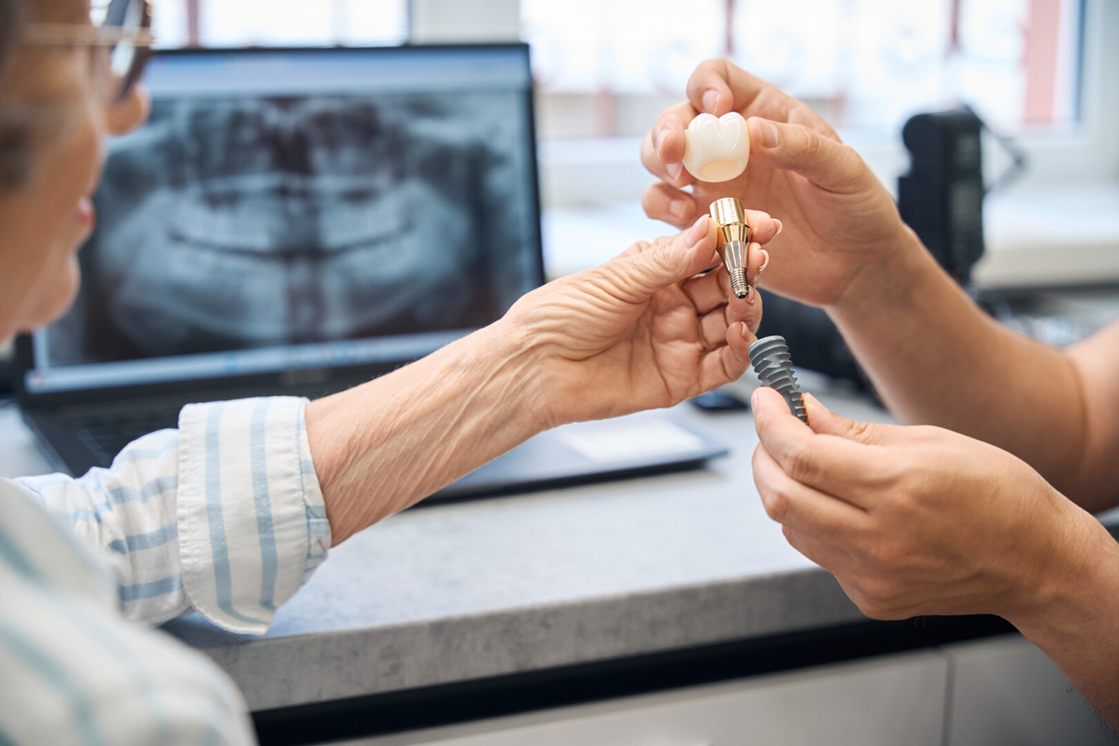 dental implant price Singapore