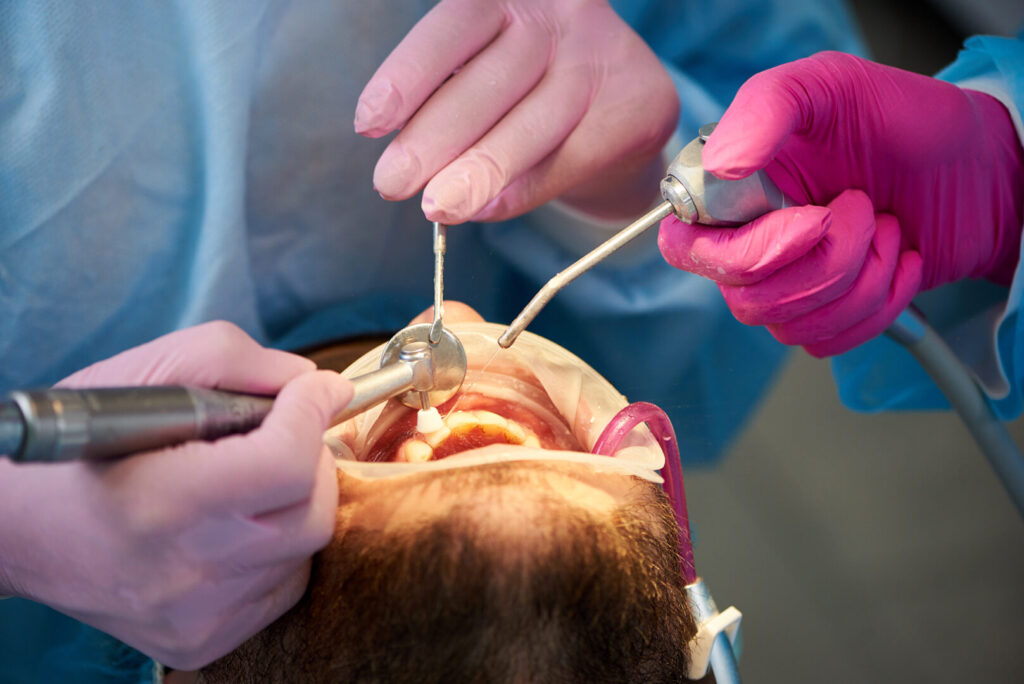 dental implants Singapore