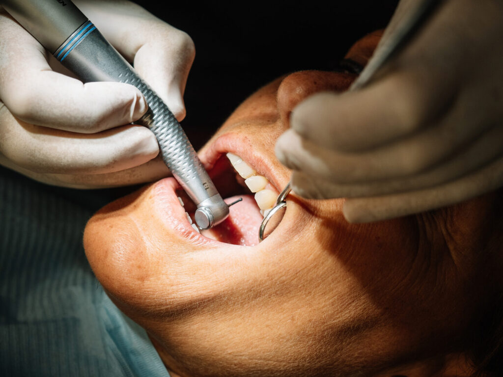 tooth crown cost Singapore