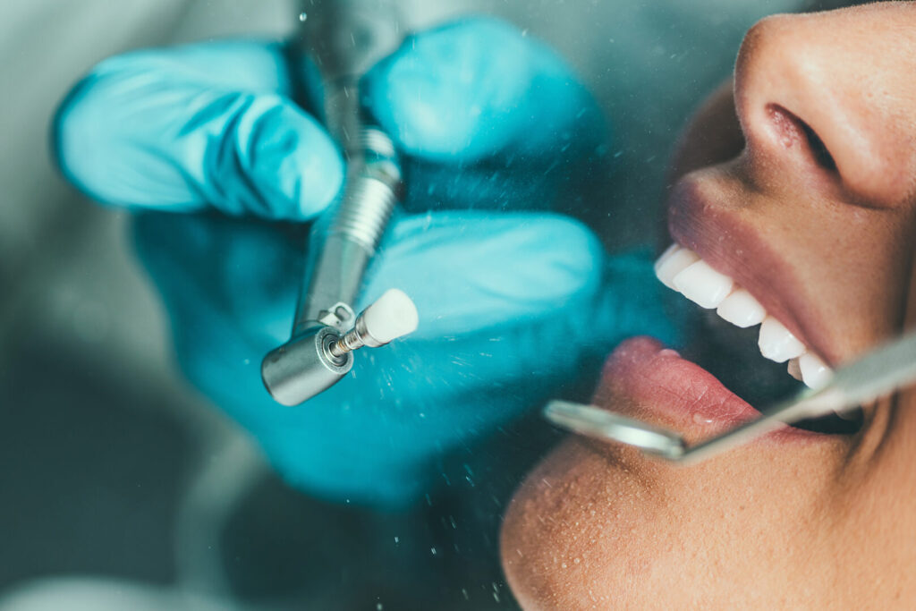 tooth crown cost in Singapore