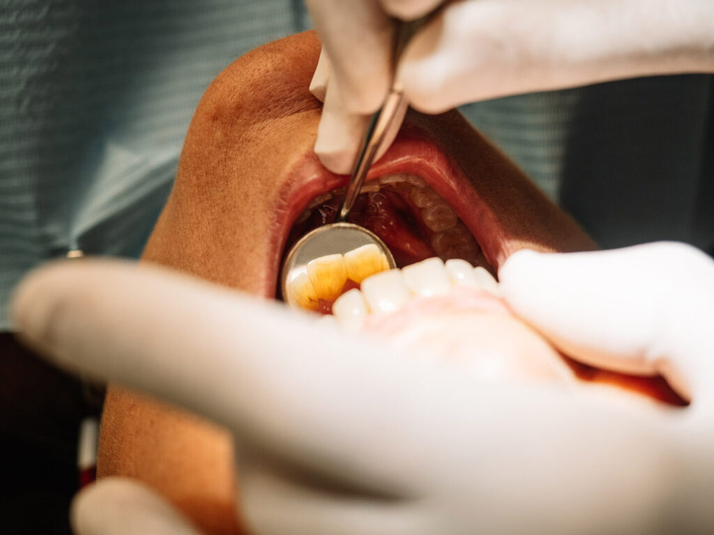 tooth crown pain