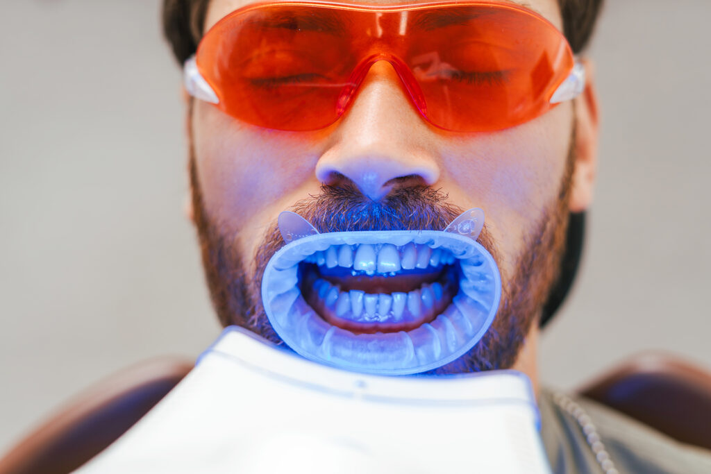 teeth whitening Singapore