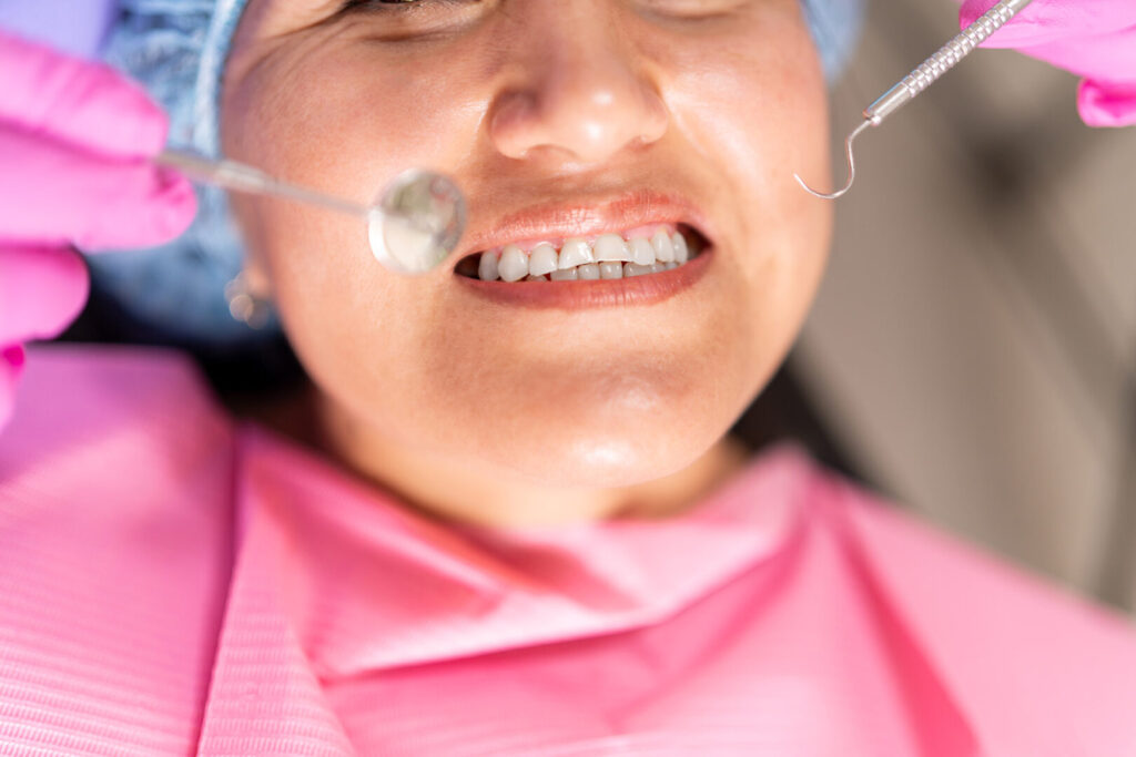 bonding teeth pros and cons