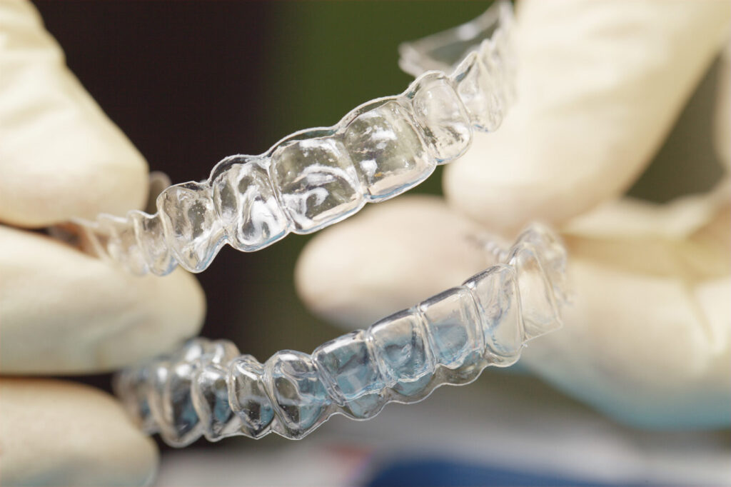 clear braces cost