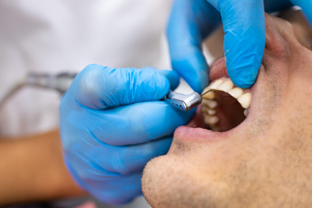 periodontal disease treatment