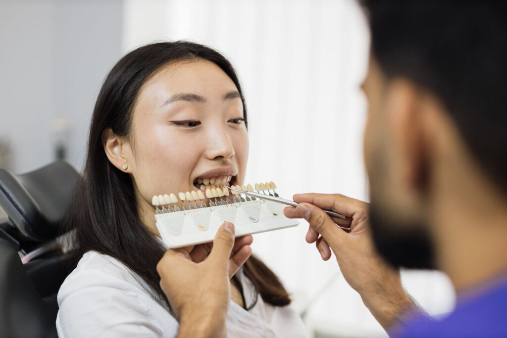 porcelain veneers