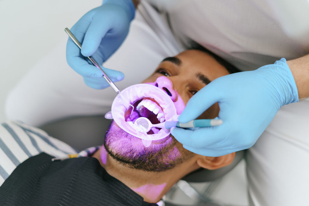 teeth whitening Singapore cost