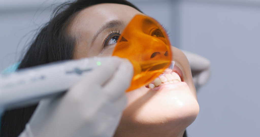 tooth whitening Singapore