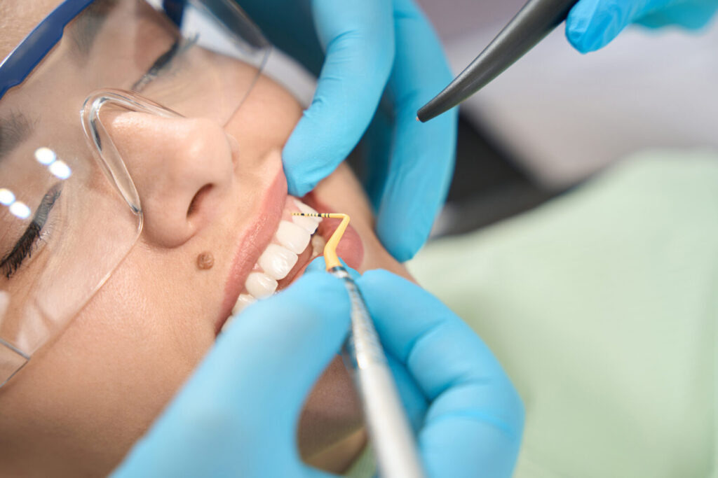 what is periodontal disease