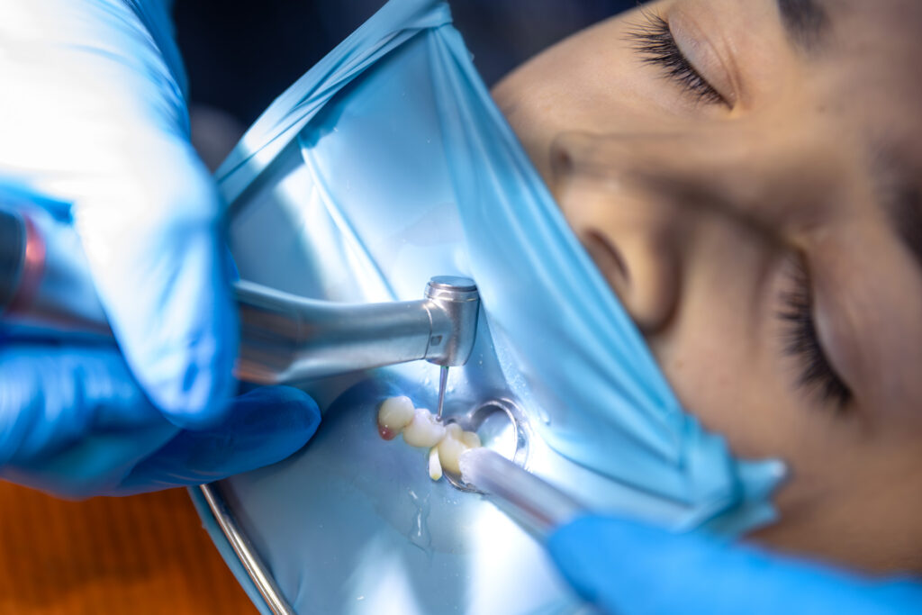 are dental fillings painful