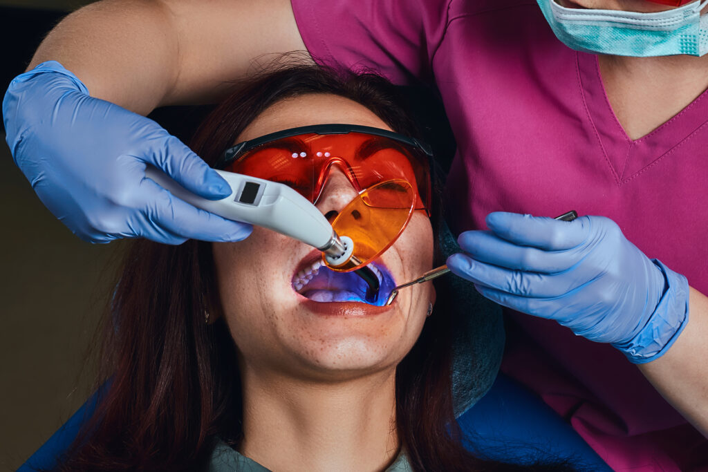 dental filling