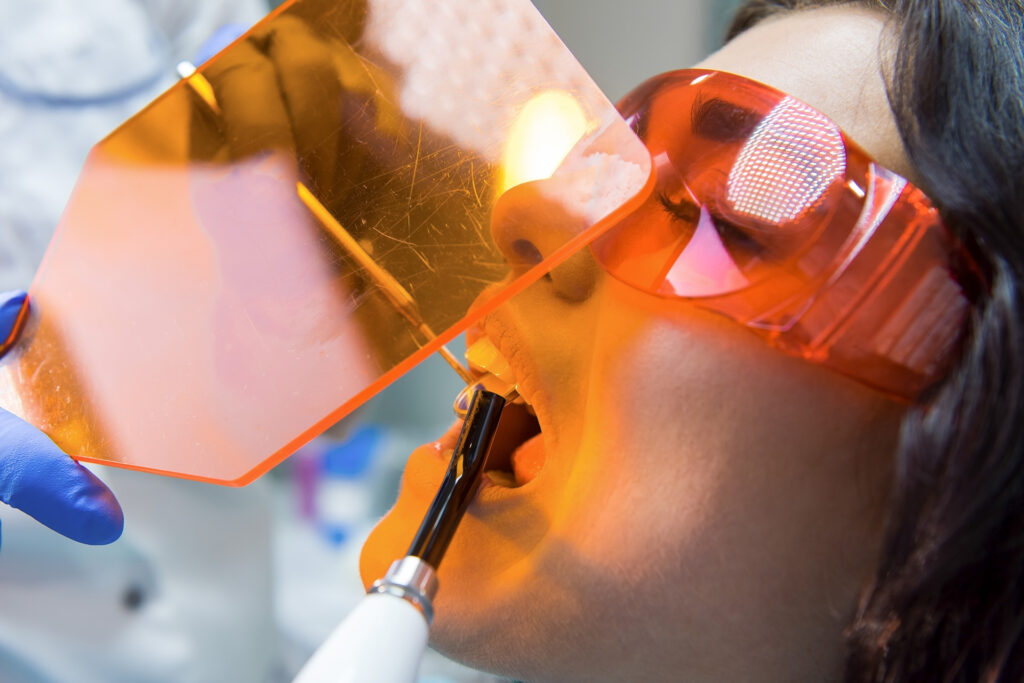 dental filling Singapore
