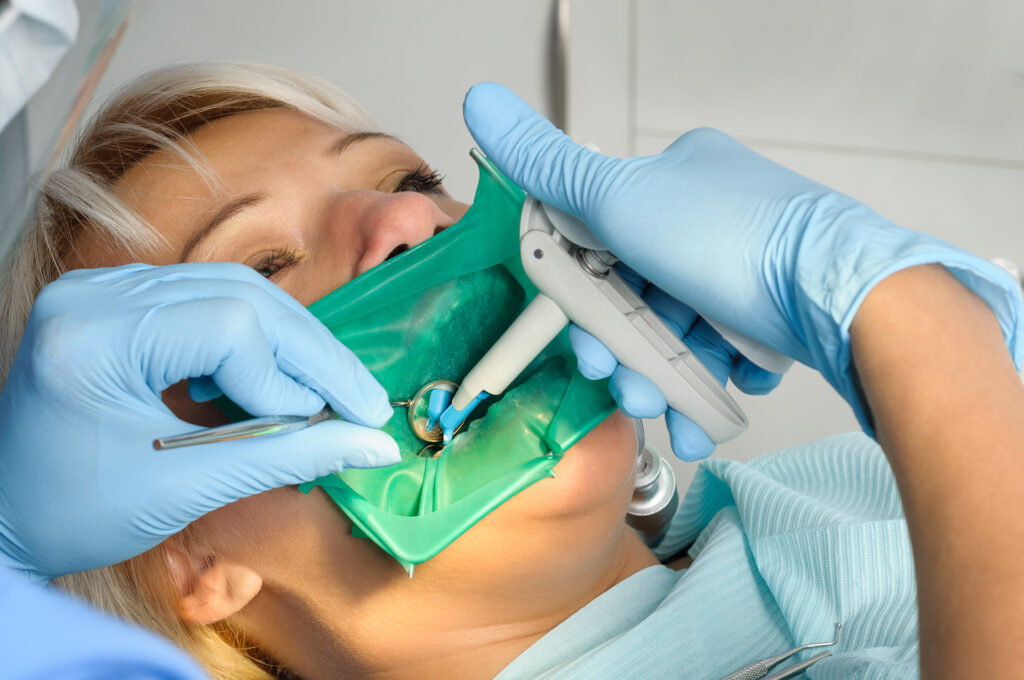dental fillings