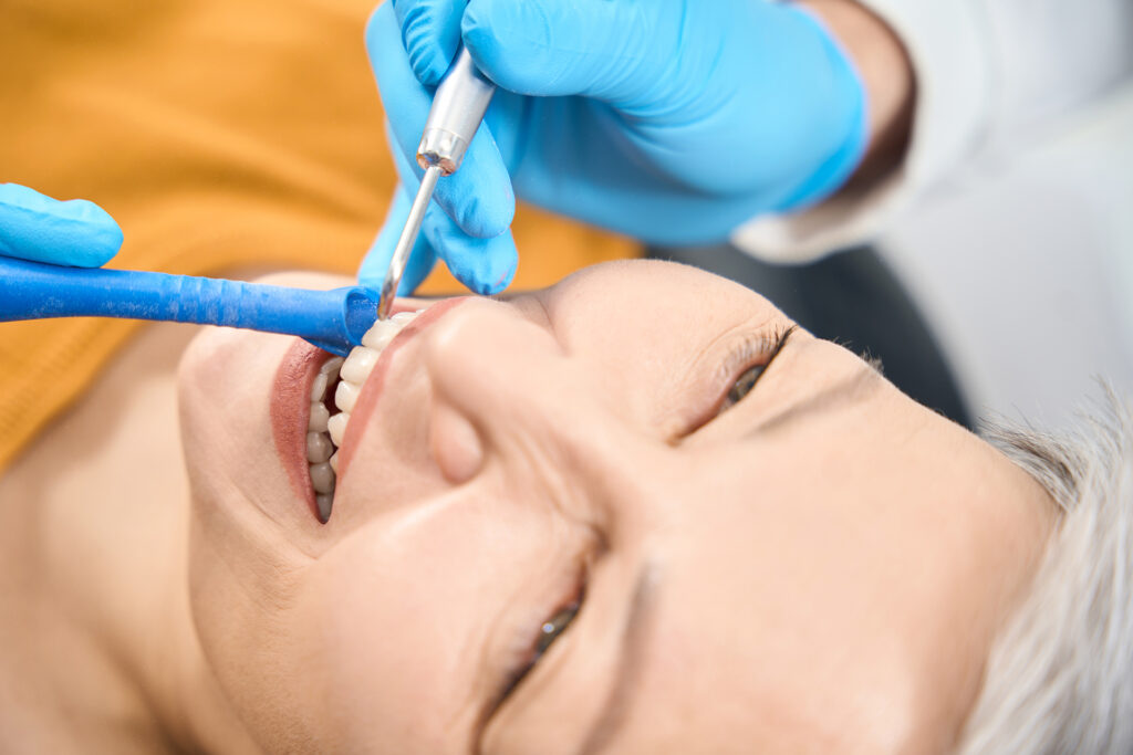 dentist filling