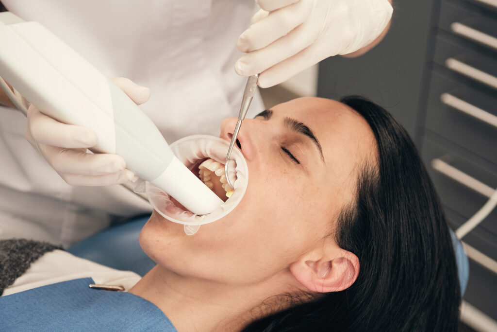 dental filling in Singapore