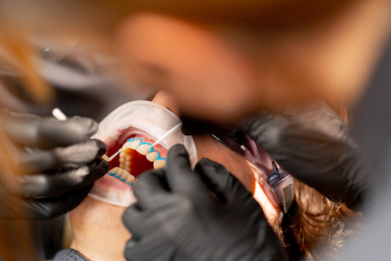 gingival recession treatment