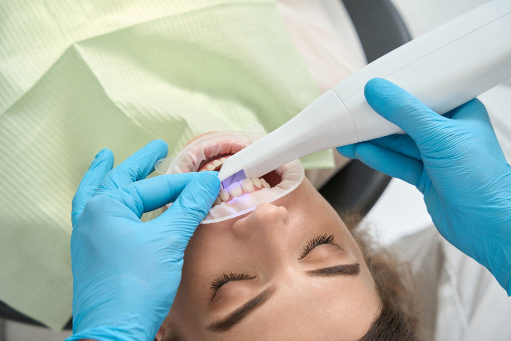 how long does a dental filling last
