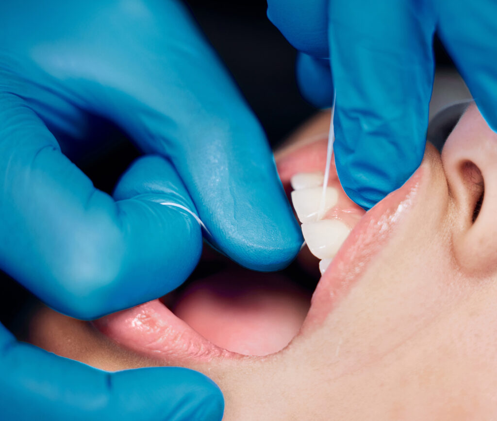 receding gums treatment Singapore