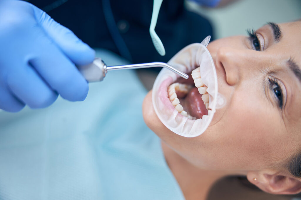 root canal treatment Singapore