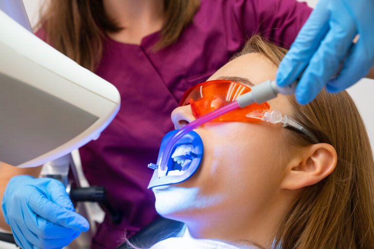 teeth whitening at dentist